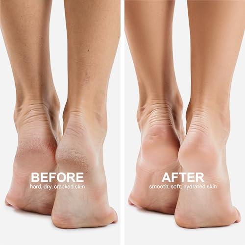 Moisturizing Foot Mask 24-Pair Set with Shea Butter 2 Moisturizing Foot Mask 24-Pair Set with Shea Butter - Image 2