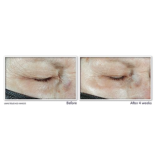 RoC Hyaluronic Acid Eye Cream and Retinol Capsules 5 RoC Hyaluronic Acid Eye Cream and Retinol Capsules - Image 5