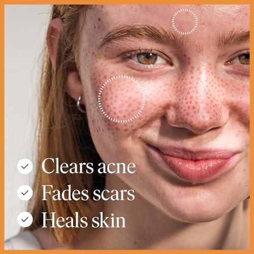 47 Skin Hydrating Face Serum for Acne Scars and Dark Spots 2 47 Skin Hydrating Face Serum for Acne Scars and Dark Spots - Image 2