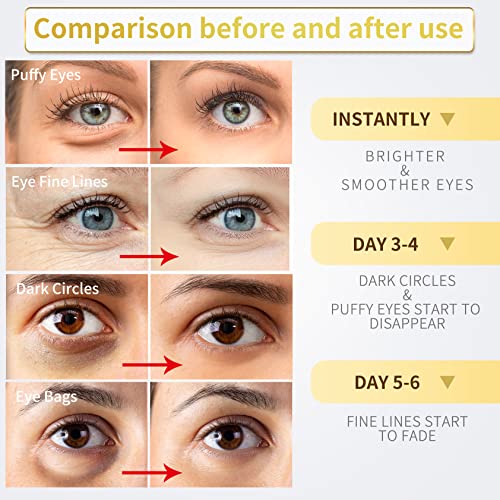 NAZANO 24K Gold Under Eye Patches for Dark Circles 3 NAZANO 24K Gold Under Eye Patches for Dark Circles - Image 3